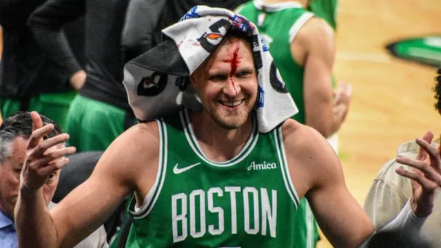 Kristaps Porzingis with a head injury